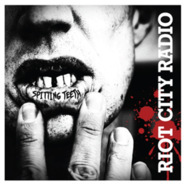 Riot City Radio - Spitting Teeth (Vinyl)