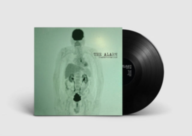 Alarm - Transformation (Vinyl)