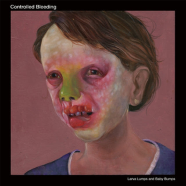 Controlled Bleeding - Larva Lumps And Baby Bumps (Vinyl)