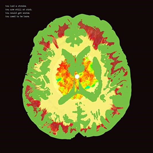 Minus 5 - Stroke Manor (CD)