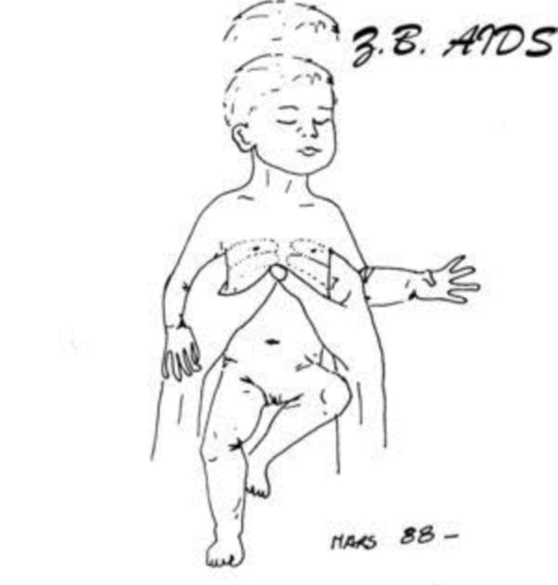 Z.B. Aids - Gestalt (Vinyl)